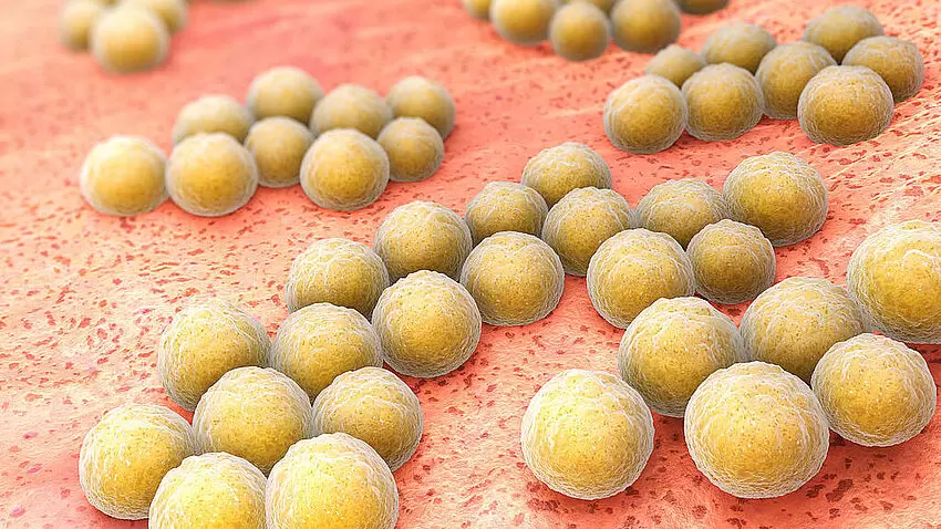 MRSA Keime